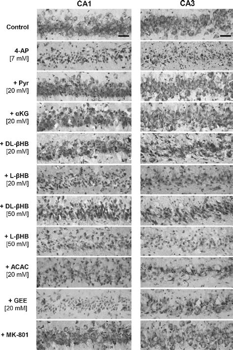 Representative Micrographs Of The Ca1and Ca3 Regions Of The