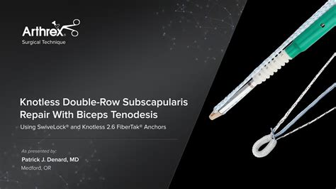 Arthrex Knotless Double Row Subscapularis Repair With Biceps