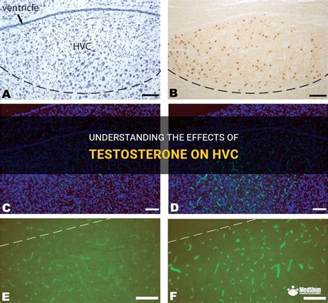 Understanding The Effects Of Testosterone On Hvc Medshun