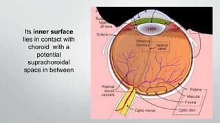 Diseases of sclera | PPT