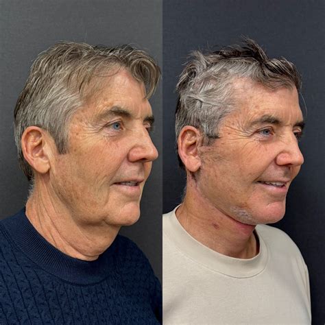 The Secret to a Youthful Face: Why Your Neck Holds the Key