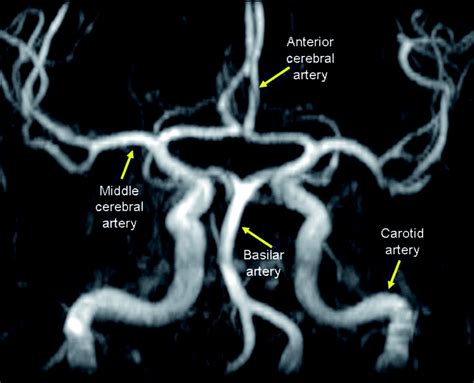 magnetic resonance imaging practical neurology