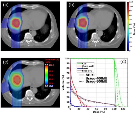 Use Of Single‐energy Proton Pencil Beam Scanning Bragg Peak For Intensity‐modulated Proton