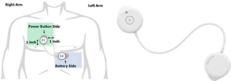 Frontiers A Descriptive Study Of The Clinical Impacts On Covid