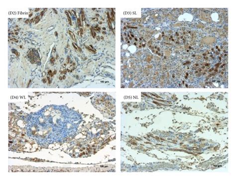 Immunohistochemical Staining With Hbme 1 Cd68 Cd163 And Cd86 A1 To Download Scientific