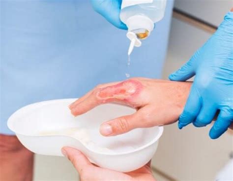 Wound Cleaning Importance And Techniques Flen Health