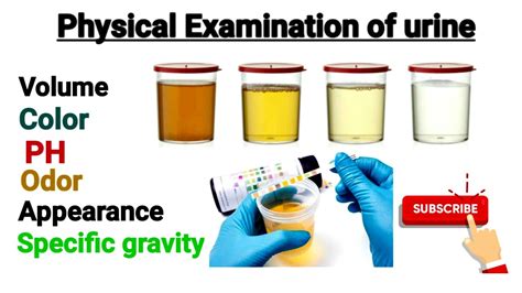 Blood Protein And High Specific Gravity In Urine At Ruby Jesse Blog