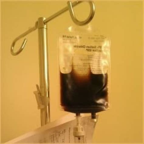 Iron Infusion Cost In Canada At Georgenstanleyo Blog