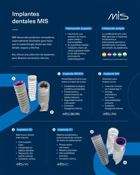 Cualquier Lo Que Debes Saber Sobre Los Implantes Dentales Consejos