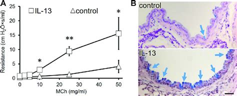 Il 13 Induces Airway Hyperresponsiveness And Goblet Cell Metaplasia A