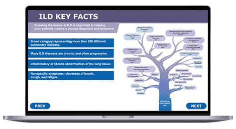 Clinician Toolkit Timely Diagnosis For Ild American College Of