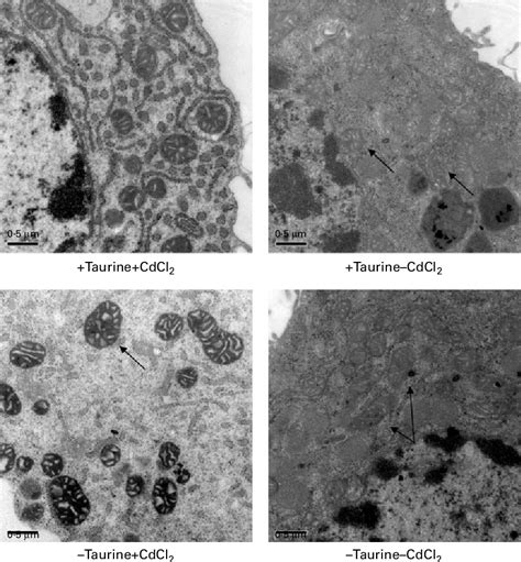 Pdf Taurine Attenuates Apoptosis In Primary Liver Cells Isolated From