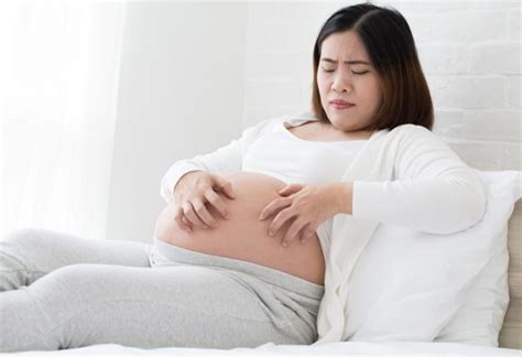 Rashes During Pregnancy Types Causes And Home Remedies