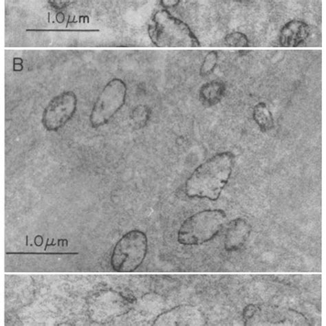 DAB Stained Mitochondria In HeLa Cells Grown In The Absence A Or