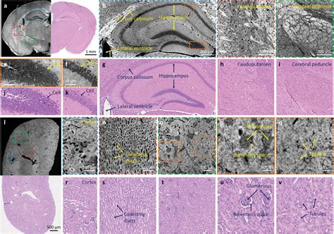 Mouse Hippocampus Histology 