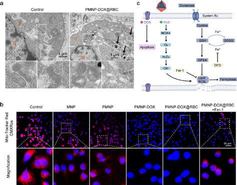 A Bio TEM Images Of The MCF 7 ADR Cells Co Incubated With PMNP DOX RBC