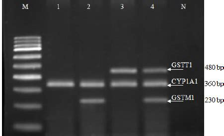 Multiplex Pcr Amplification Of Gstm And Gstt Was Resolved On