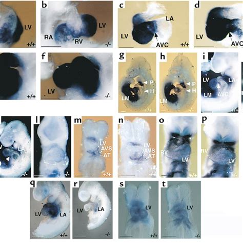 Cardiac Looping Morphogenesis In 95 Dpc Embryos A And C Right And