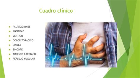 Taquicardia Supraventricular Manejo Y Vigilancia Ppt