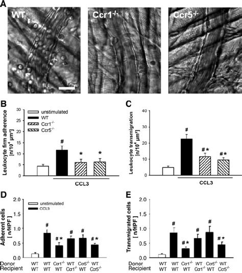 Role Of Ccr1 And Ccr5 For Ccl3 Elicited Leukocyte Responses A