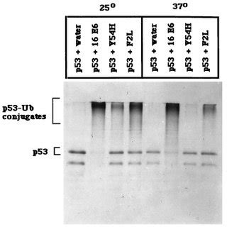 Ubiquitination Of P53 By E6 And E6 Mutants In Vitro Translated 35