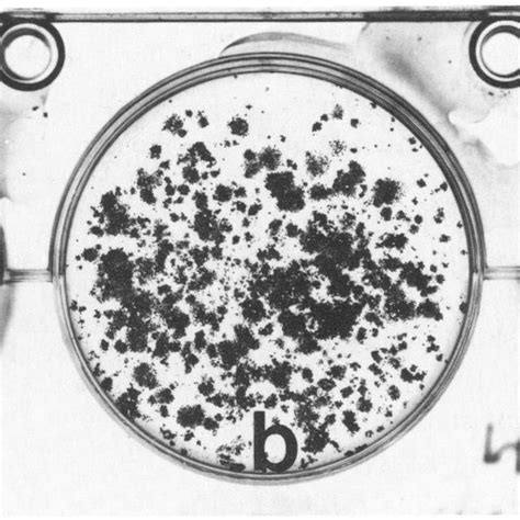 Bright Field Micrograph Of Glomerular Cells Grown In A Defined Medium