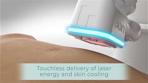 Eon Body Contouring And Fat Reduction Laser At The Shaw Center Youtube