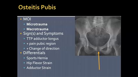 ATR6087 Hip Pathologies YouTube