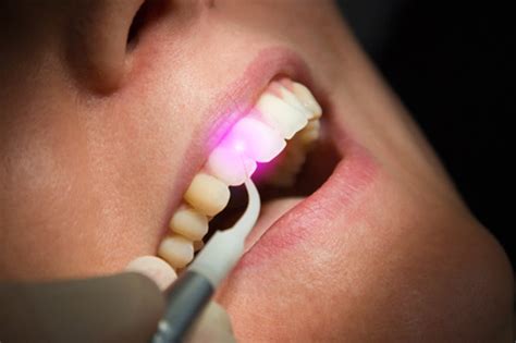 Laser Gum Treatment Savannah Ga Benjamin Duval Dds