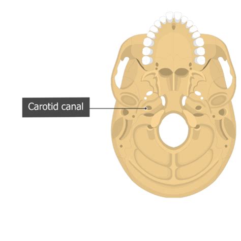 Foramen Lacerum Temporal Bone