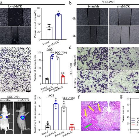 Umtck Facilitates Gc Cell Migration Invasion In Vitro And Liver Download Scientific Diagram