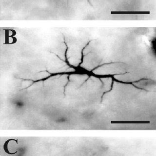 ~A! Mosaic of A horizontal cells of the agouti retina at 11 mm ventral ...