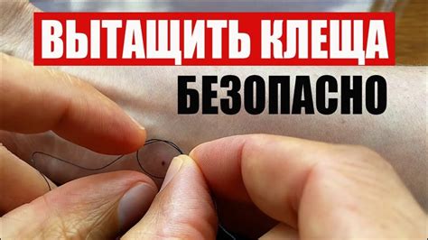Укусил Клещ Что Делать. Как Вытащить Клеща Ниткой - YouTube