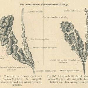 Antique Male Sex Organs Print Scrotum Testicles Male Reproductive System Gynaecological Art