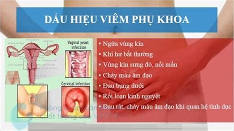 Các Dấu Hiệu Viêm Nhiễm Phụ Khoa Nhận Biết Sớm Để Bảo Vệ Sức Khỏe