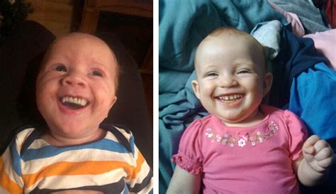 Funny and Adorable Images of Babies Wearing Dentures to Make You Laugh