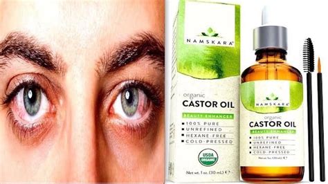 Remove Cataract Without Surgery And Improve Eyesight Fully With Castor