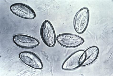 Giardia Ova