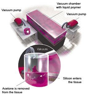 BodyWorlds plastination process | Acetone, Vacuum pump, Body