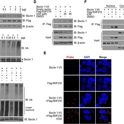 Icm Inhibits The Nucleocytoplasmic Translocation Of Hmgb1 A Hek293t