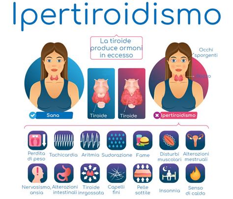 Ipertiroidismo Sintomi Cause E Trattamento Microbiologia Italia