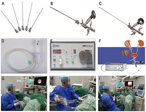 Frontiers Comparison Of The Efficacy Of Shuotong Ureteroscopy And