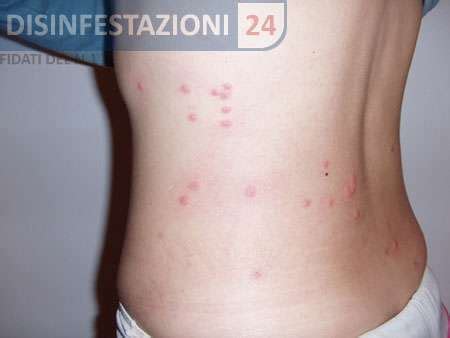 Morso Della Pulce Come Riconoscerlo Prevenirlo E Curarlo