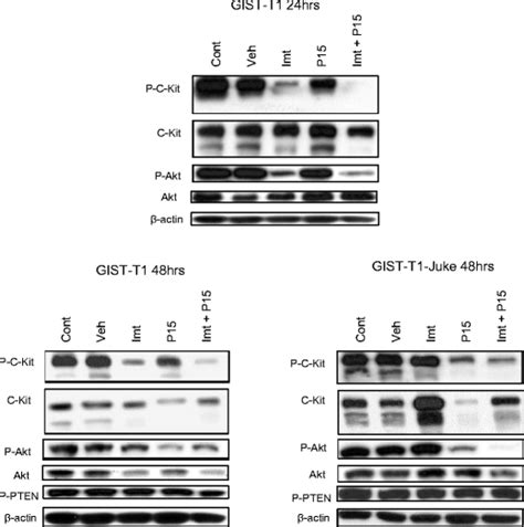 PBOX 15 Imatinib Combination Inhibits C KIT And C KIT Dependent