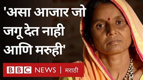 सिकलसेल अ‍ॅनिमिया ‘ना जगू देतो ना मरू देतो असा जीवघेणा आजार Bbc