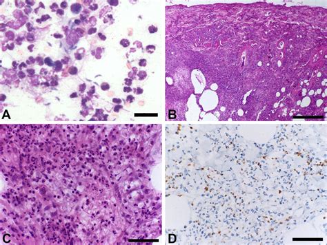 Immunosuppressed Dog With Cutaneous Toxoplasmosis A Cytology