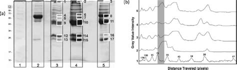 Human Plasma Protein Adsorption Onto Alumina Nanoparticles Relevant To