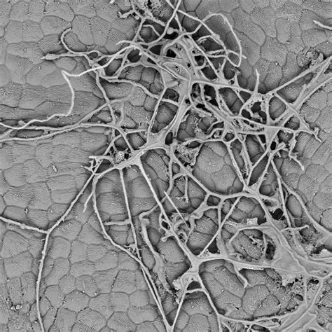 Inmunidad prefacio Desafortunadamente microscopia electronica barrido Pequeño Bergantín comentarista