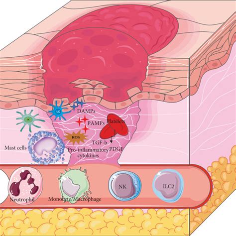 Inflammatory phase of wound healing. Main innate cells that invade... | Download Scientific Diagram