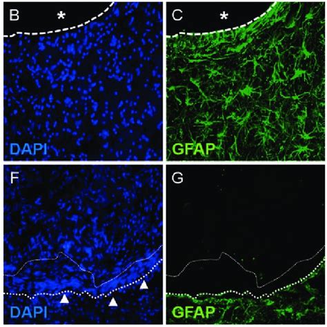 Immunohistochemistry For Gfap And Iba I Revealing The Tissue Interface